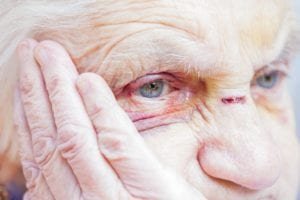 Injured elderly woman's eyes and nose