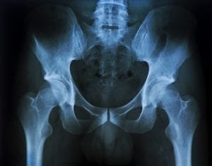 X-ray image of the pelvis