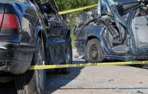 Can a Car Accident Cause MS (Multiple Sclerosis) A Must-Read