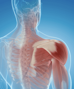 SLAP Tear Car Accident Settlements